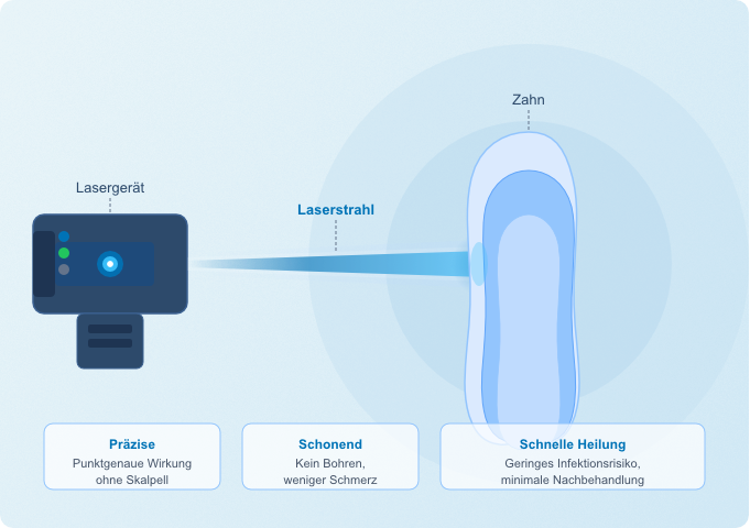 Laserbehandlung beim Zahnarzt – schonende und präzise Behandlung ohne Skalpell